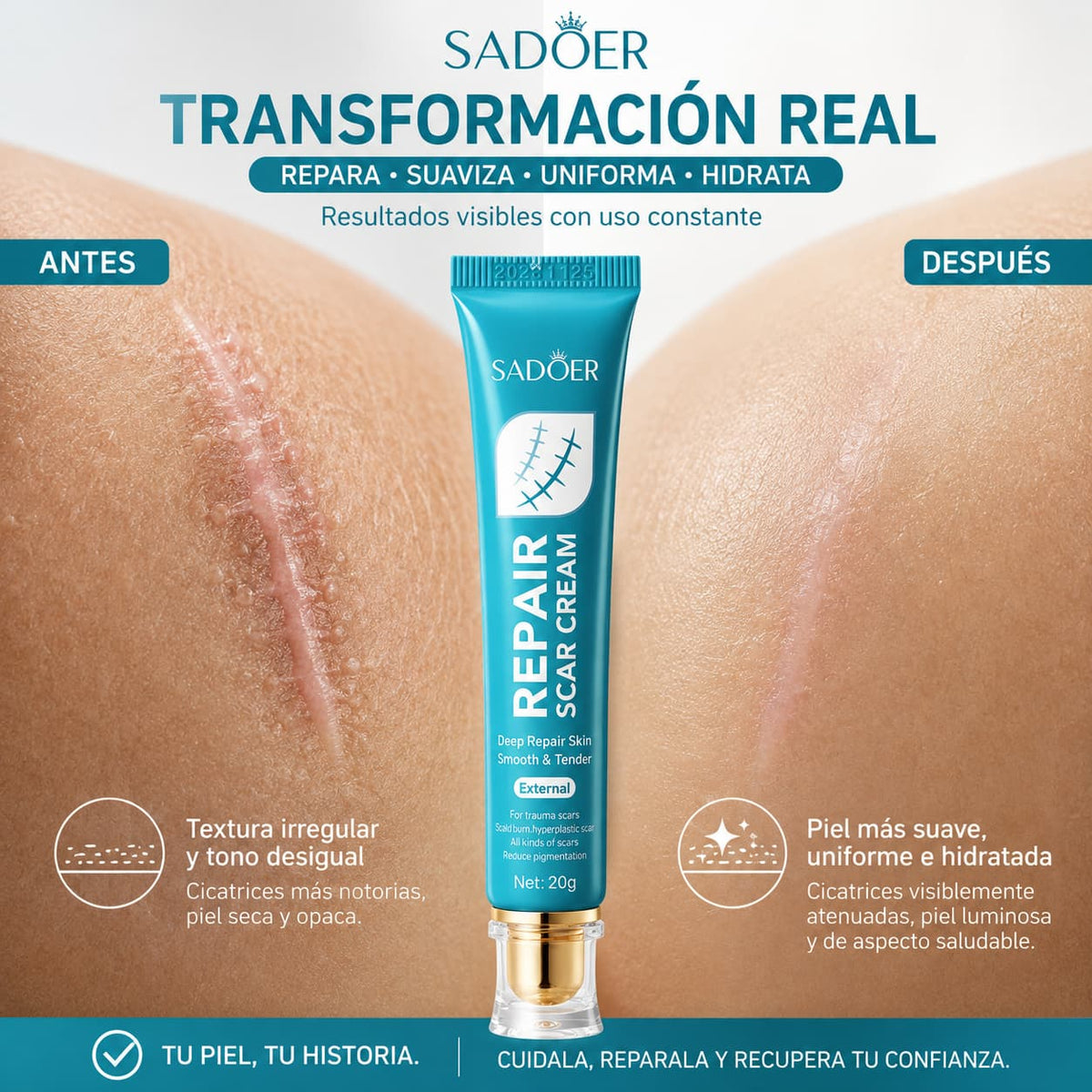 SADOER SCAR REPAIR™ 20G – TRATAMIENTO REPARADOR PROFUNDO PARA CICATRICES ✨💧 PIEL MÁS LISA Y UNIFORME